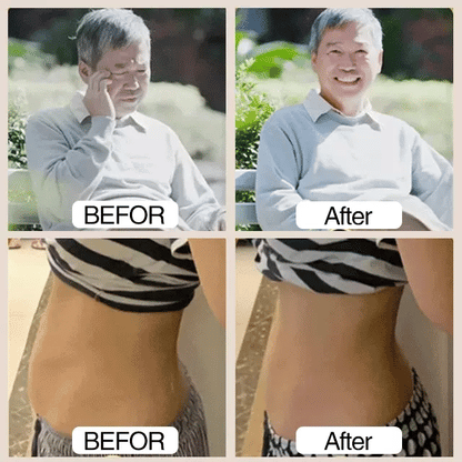 𝐒𝐮𝐠𝐚𝐫 𝐂𝐨𝐧𝐭𝐫𝐨𝐥 𝐋𝐈𝟒 𝐀𝐜𝐮𝐩𝐫𝐞𝐬𝐬𝐮𝐫𝐞 𝐏𝐨𝐢𝐧𝐭 𝐂𝐥𝐢𝐩 (𝐈𝐦𝐩𝐨𝐫𝐭𝐞𝐝)