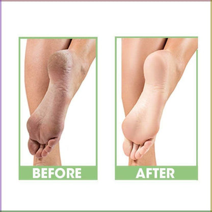 𝐒𝐢𝐥𝐢𝐜𝐨𝐧𝐞 𝐆𝐞𝐥 𝐒𝐨𝐜𝐤𝐬 𝐟𝐨𝐫 𝐌𝐞𝐧 & 𝐖𝐨𝐦𝐞𝐧 + 𝐅𝐫𝐞𝐞 𝐇𝐨𝐦𝐞 𝐃𝐞𝐥𝐢𝐯𝐞𝐫𝐲